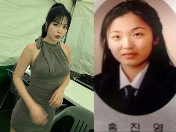 홍진영 과거 사진 화제, 성형 3번 고백까지…어린 시절 모습에 관심 쏠린 이유