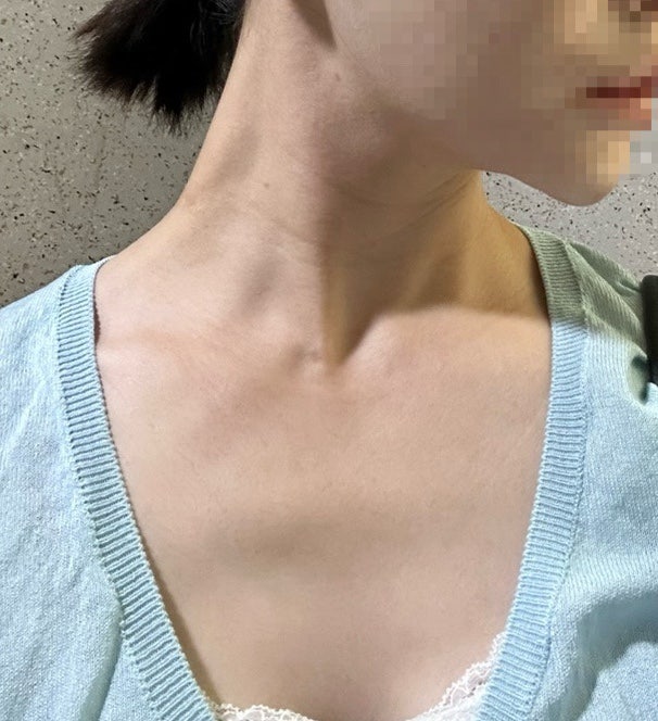 가드름 없애는 법,바디워시 바꾸고 싹사라짐 나만 알기 아쉬워서 공유