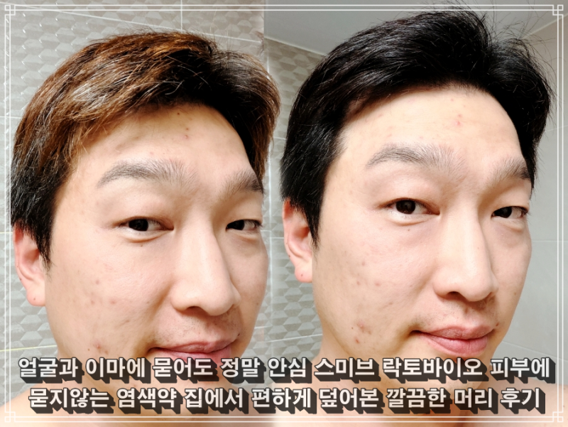 얼굴과 이마에 묻어도 안심 스미브 락토바이오 피부에 묻지않는 염색약 후기