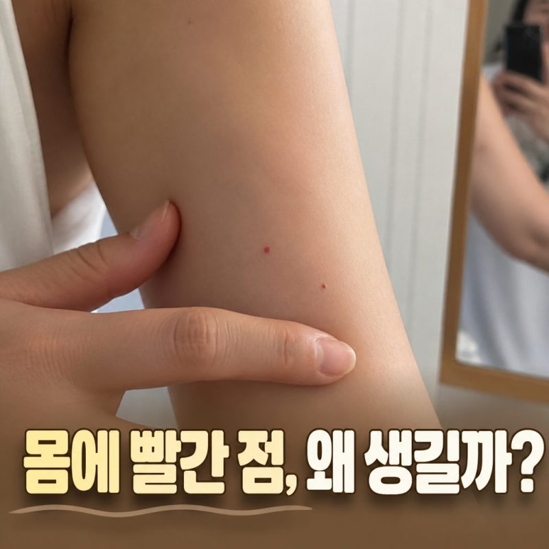 몸에빨간점 왜 생길까? 혈관종부터 피부질환까지 원인 정리