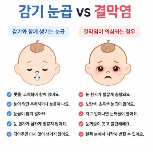 아기 눈곱 감기일까 결막염일까?ㅣ눈곱색깔 충혈 전염여부 총정리
