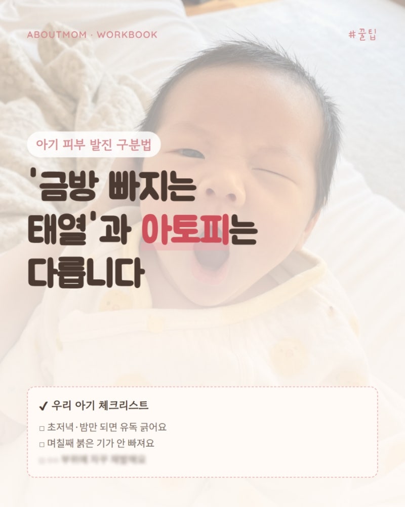 아기 피부 발진 아토피 구분법, 엄마표 진단 기준
