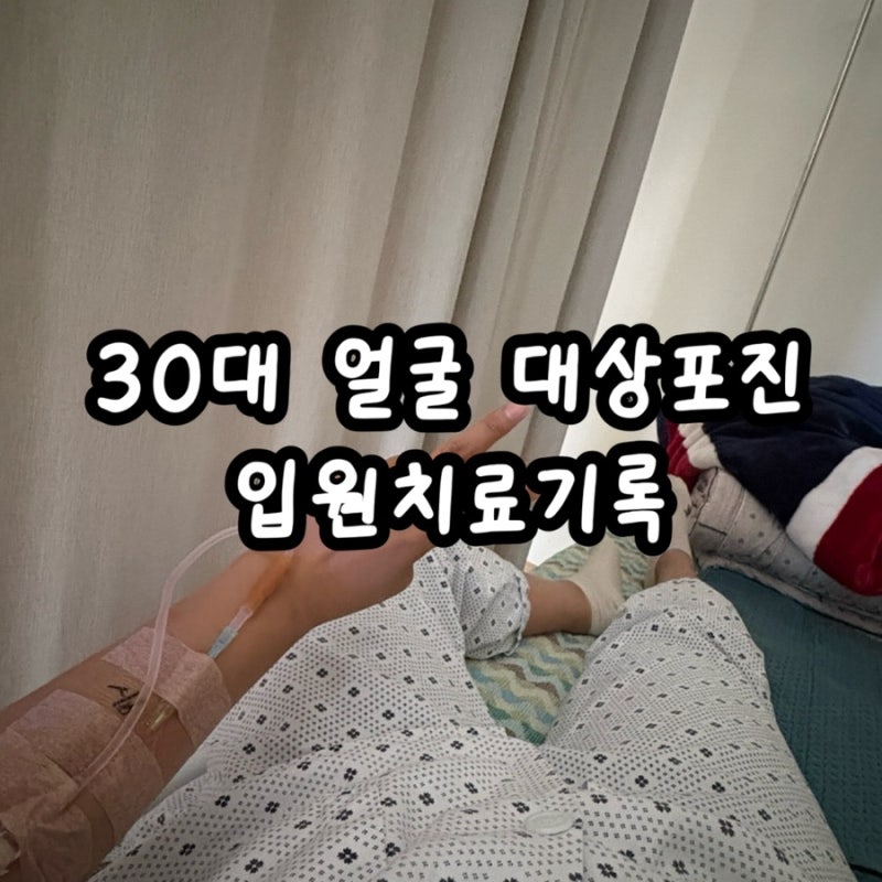 얼굴 대상포진 입원치료기 1탄 (왜째서 걸린걸까)