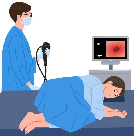 대장내시경 40대부터!!