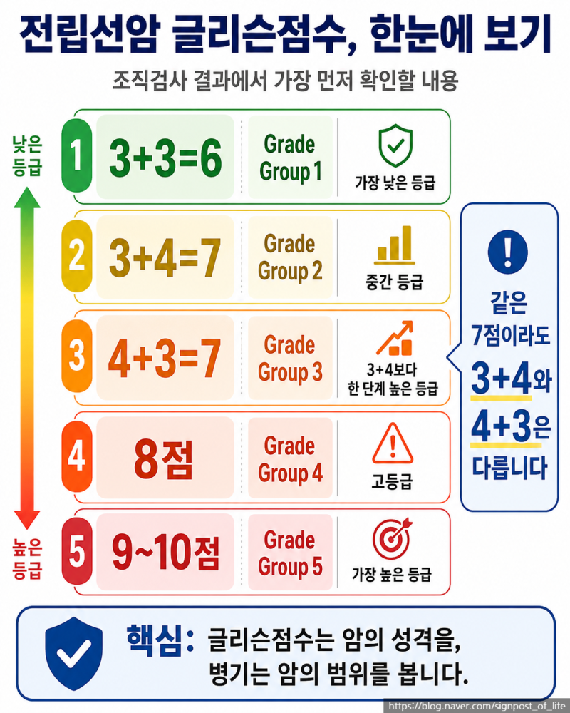 전립선암 글리슨점수 6·7·8, 얼마나 심한 걸까?