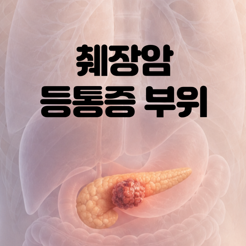 등통증 이 부위면 위험? 췌장암 초기증상 5가지와 검사방법