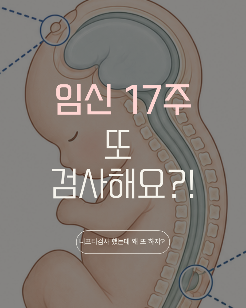 임신 17주 신경관결손검사 후기｜NIPT 했는데 왜 또 검사할까?