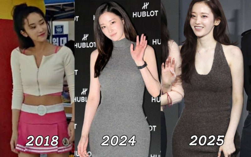 [허파고리 수술?] "나도 전종서 골반 라인 가질래!" 2030 여성들 몰리는 '허파고리 수술'… 2년 ....
