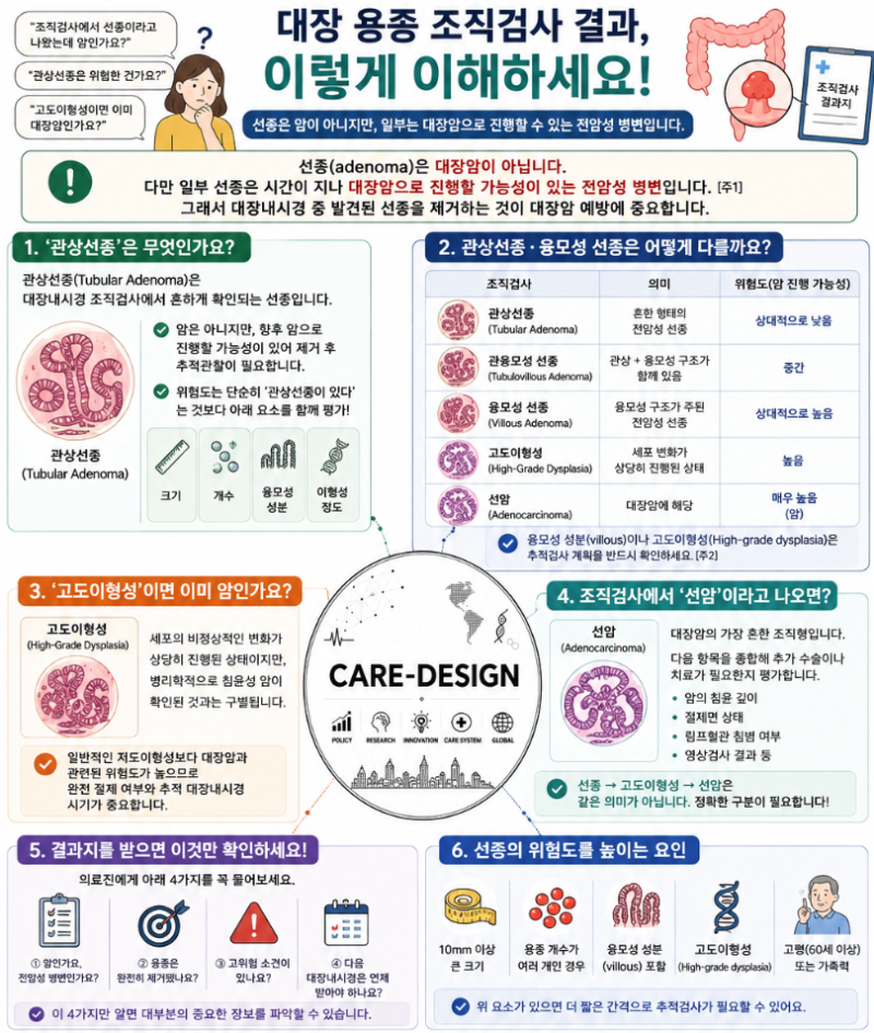 대장용종 조직검사 ‘선종’ 나왔다면?｜관상선종·고도이형성·암 차이