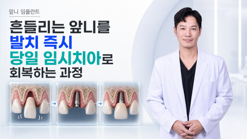 공덕 치과, 흔들리는 앞니 임플란트, 발치 즉시 임플란트와 당일 임시치아로 회복한 사례
