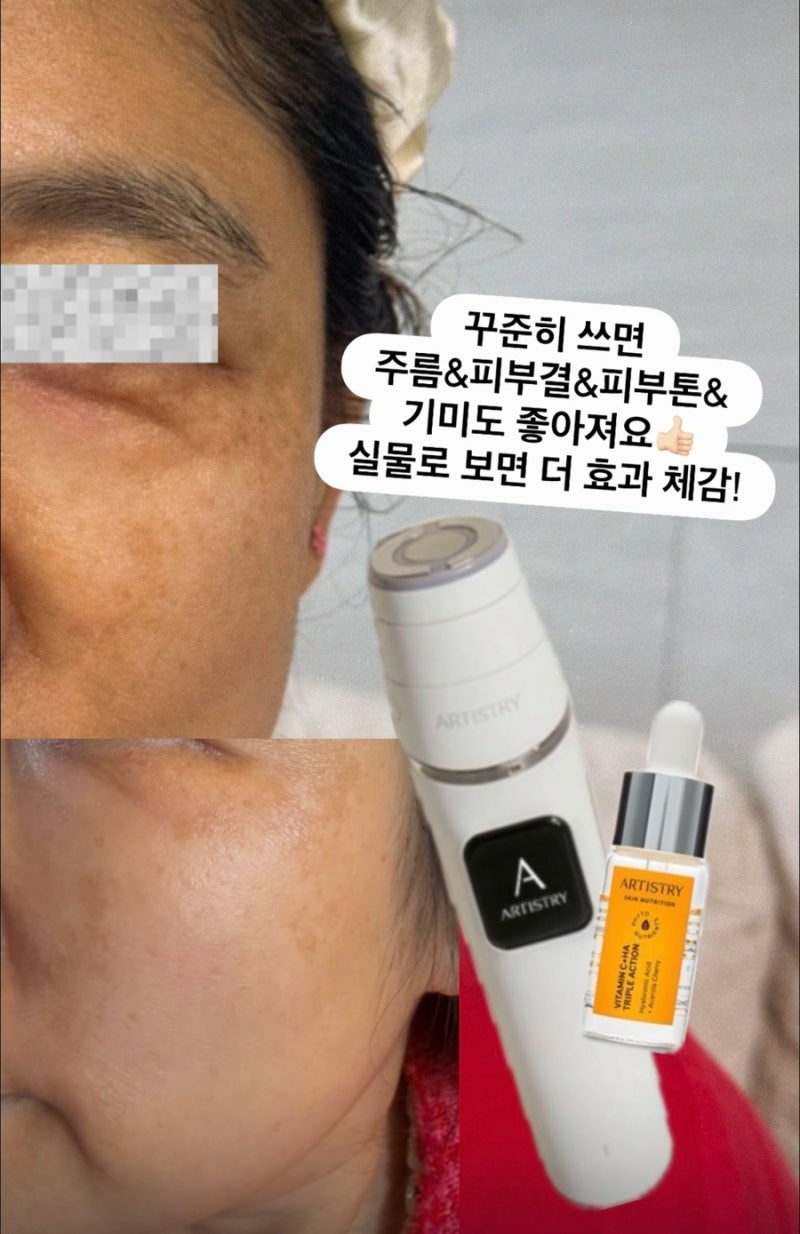 바로 오늘!! 더마 아키텍트 프로모션 자세히 안내 해 드려요! 성능좋은 뷰티디바이스 할인정....