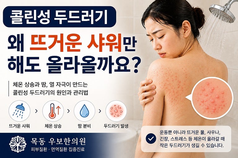 콜린성 두드러기, 왜 뜨거운 샤워만 해도 올라올까요? (목동 우보한의원)