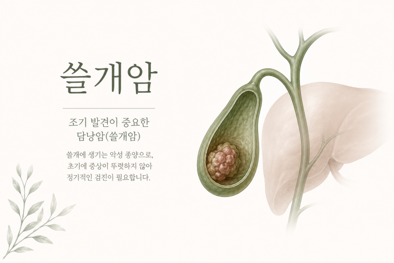 쓸개암·담낭용종, 무증상이라 더 무서울까? 놓치기 쉬운 신호 알아보기