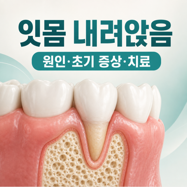 잇몸 내려앉음 원인은? 초기 증상부터 치료 방법까지 총정리