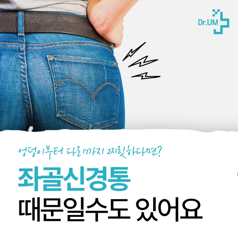 엉덩이부터 다리까지 찌릿찌릿, 혹시 좌골신경통?