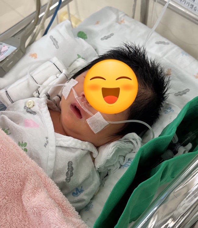신생아 호흡곤란 증후군 / 폐동맥 고혈압 / 양산부산대 신생아 중환자실