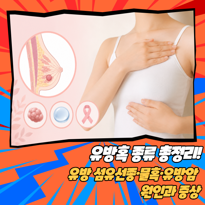 유방혹 종류 총정리! 유방 섬유선종·물혹·유방암 원인과 증상