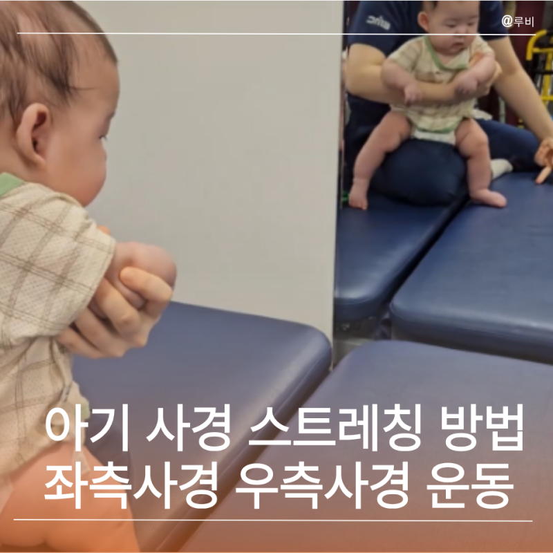아기 사경 스트레칭 방법 좌측사경 우측사경 자가운동 안내