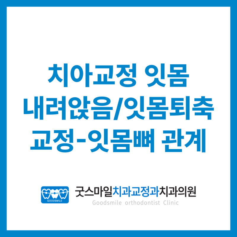 치아교정으로 잇몸 내려앉음 잇몸퇴축 교정 잇몸뼈 관계?
