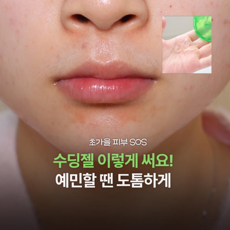 초가을 예민해진 피부에 수딩젤 이렇게 써요! 알로에수딩젤사용법