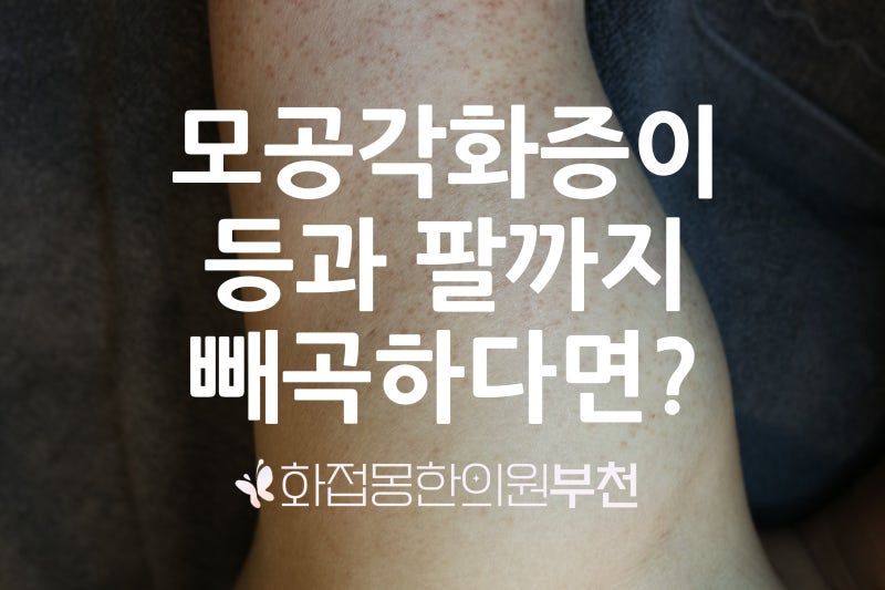 모공각화증 팔에서 등으로 빼곡한데 한 번에 없애려면? 1인실 화접몽한의원 부천