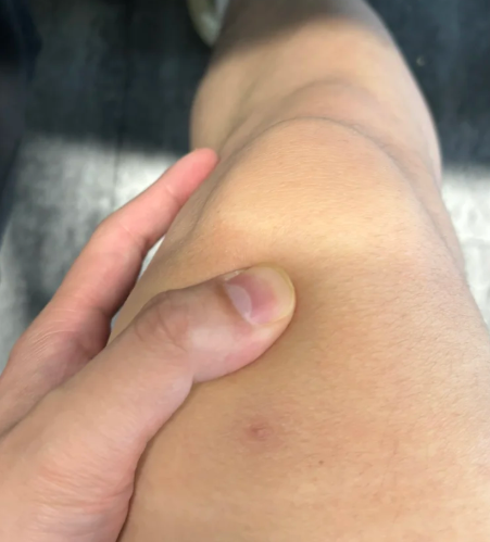 오른쪽무릎안쪽통증 걸을 때 시큰거리는 원인