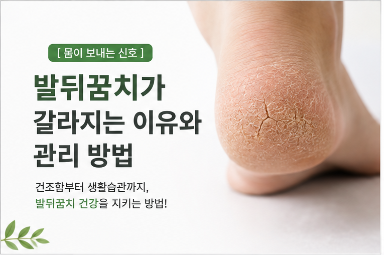 [몸이 보내는신호] 발뒤꿈치가 갈라지는 이유와 관리 방법