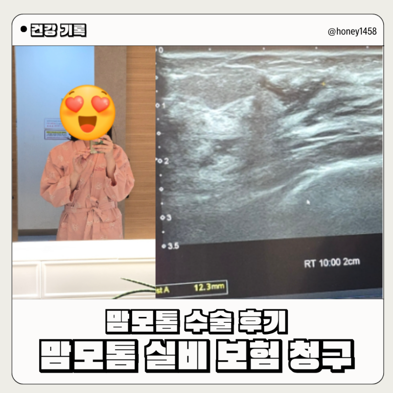 맘모톰 실비 청구 후기 : 맘모톰 보험 청구 서류 및 수술비용 입원비 특약 청구