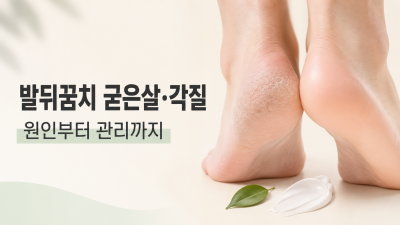 발뒤꿈치 굳은살과 각질, 왜 반복해서 생길까?