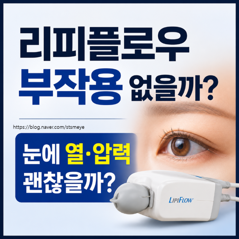 송탄 안과 : 리피플로우 부작용 없을까? 안구건조증 치료 전 꼭 알아야 할 점