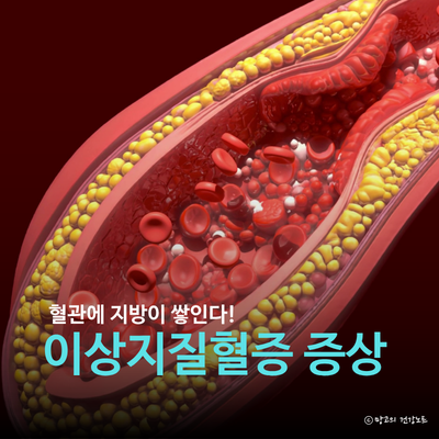 이상지질혈증(dyslipidemia)이란? 증상 원인 수치 기준 관리 고지혈증 차이점