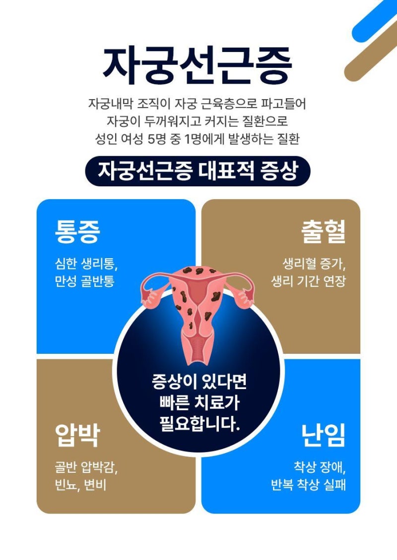 자궁선근증 크기 줄어드는 경우도 있을까?