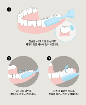 잇몸이 자꾸 내려앉는 이유?
