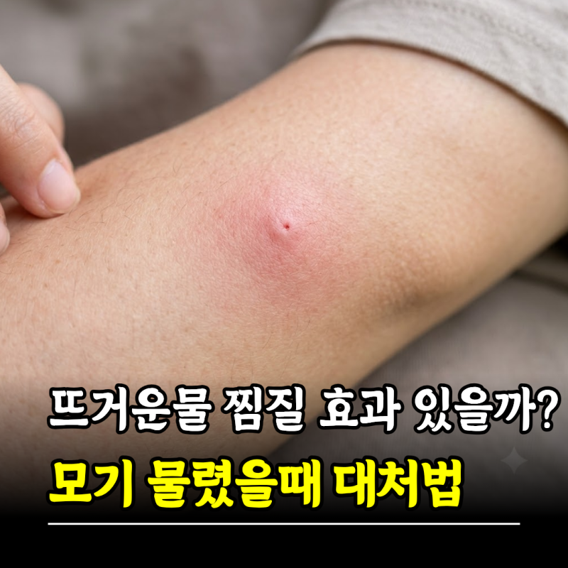 뜨거운물 찜질 효과 있을까? 모기물렸을때 대처법