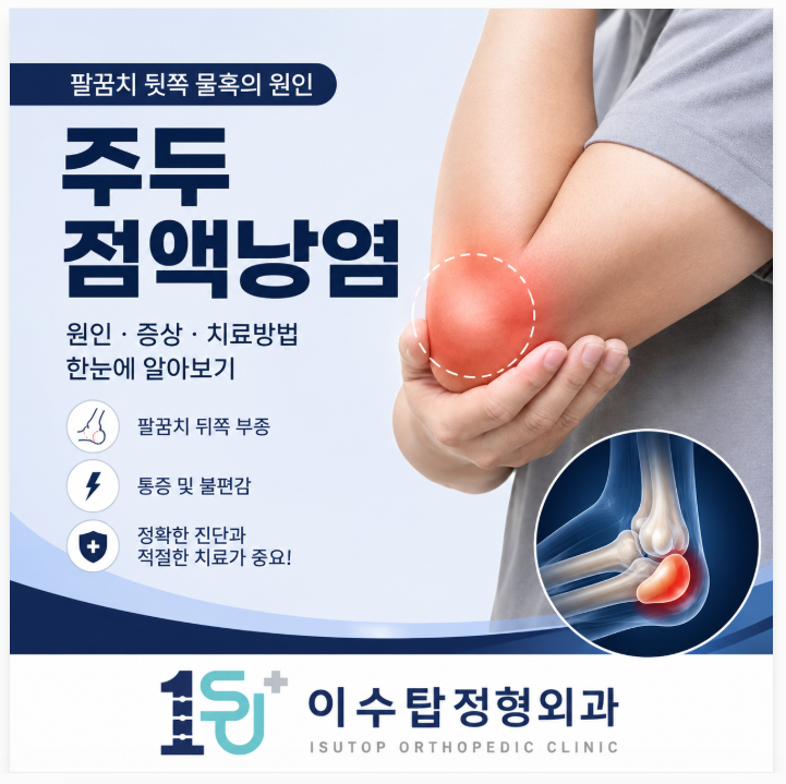 사당동 정형외과 팔꿈치에 물혹이 생겼다면? 주두점액낭염 원인과 치료 방법