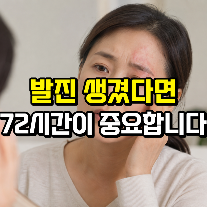 대상포진 초기증상, 몸 한쪽이 따끔거리고 아프다면 확인해보세요