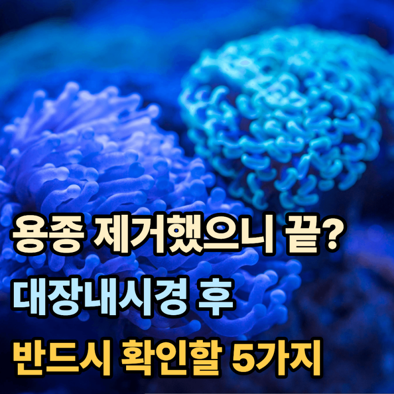 "용종 제거했으니 끝?"...대장내시경 후 반드시 확인할 것 5가지