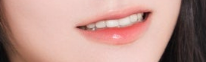 양악수술 선교정·후교정 후기｜발치교정 1년 6개월 종료, 유지장치까지