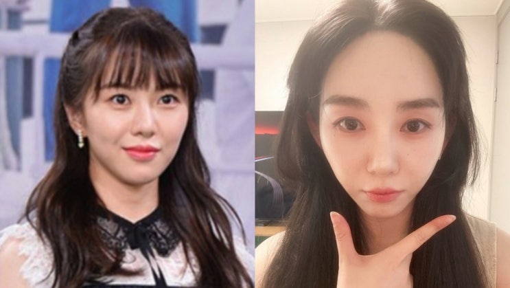 “성형 안 했다” <b>권민아</b>, 알고 보니 여러 번 받은 시술…뜻밖의 해....