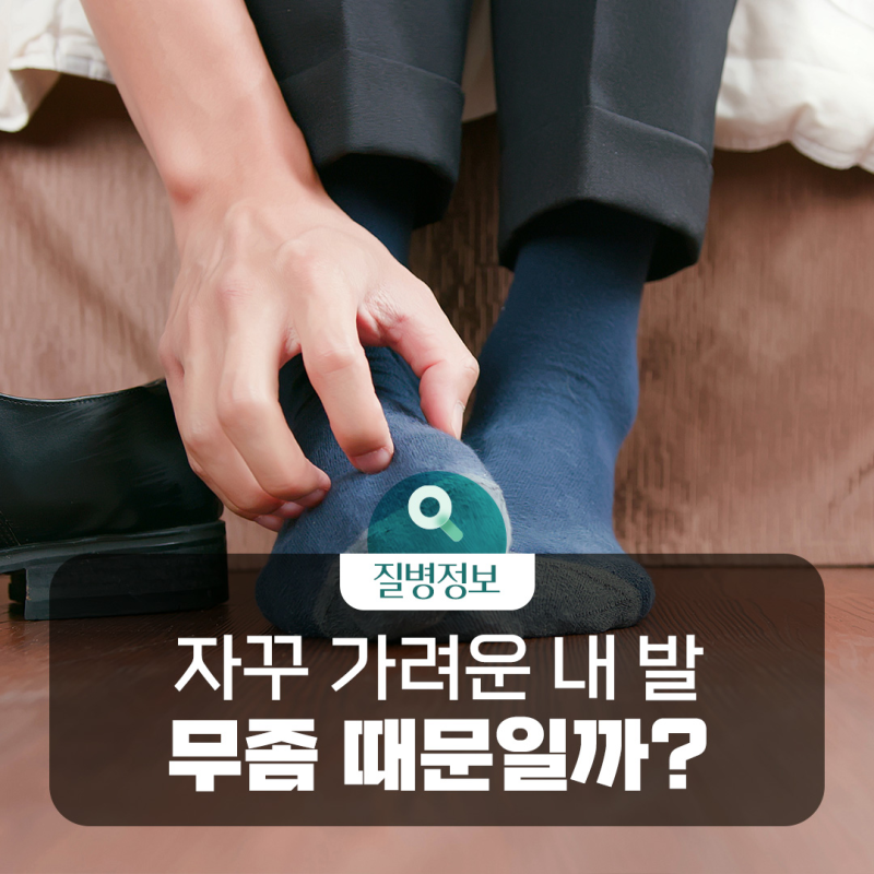 [질병돋보기] 발이 가렵고 짓무른다면? 무좀(발 백선)의 증상부터 치료·예방법까지