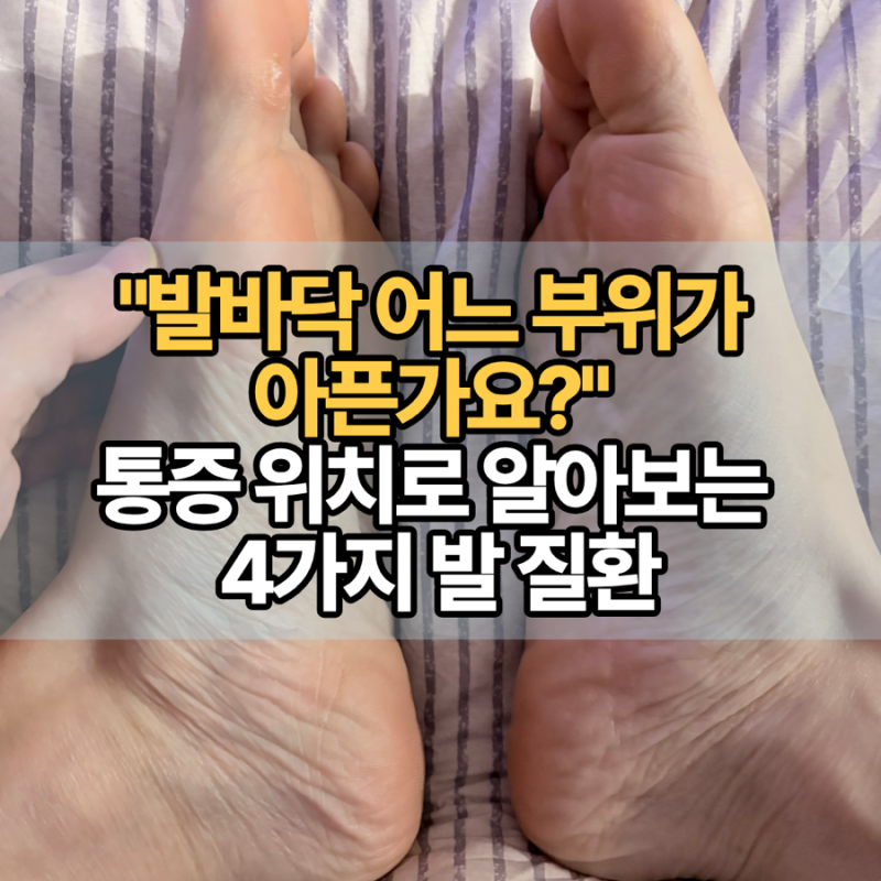 "발바닥 어느 부위가 아픈가요?" 통증 위치로 알아보는 4가지 발 질환