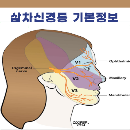 삼차신경통 기본정보