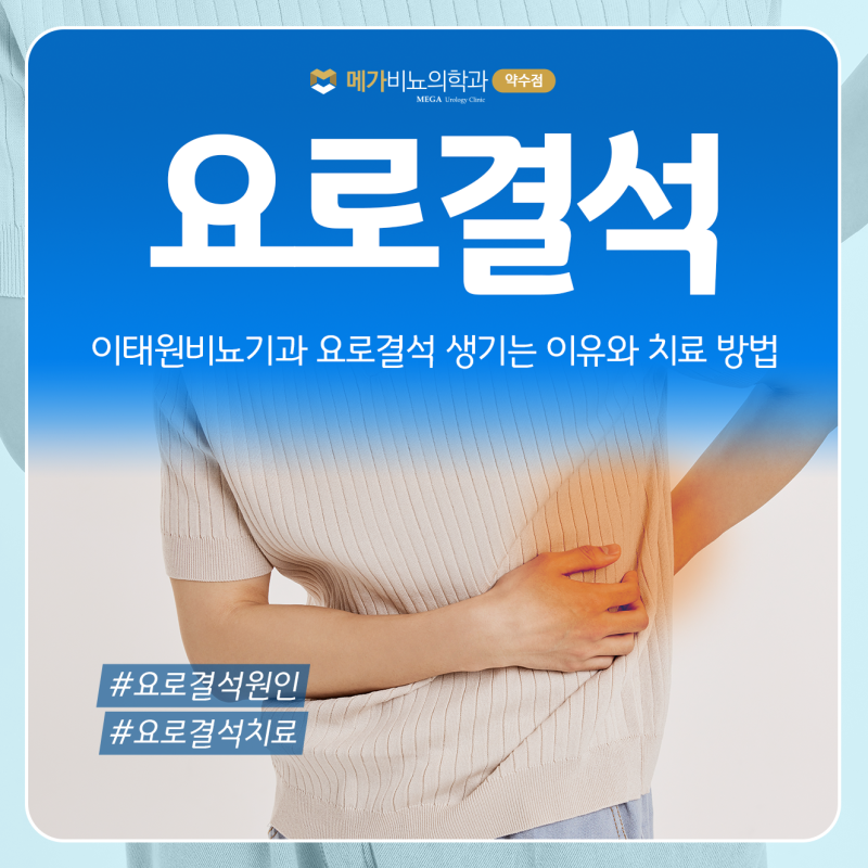요로결석이 생기는 이유와 치료 방법 이태원비뇨기과에서 알아보기