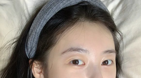모세혈관확장증 원인부터 치료방법까지 팩트체크
