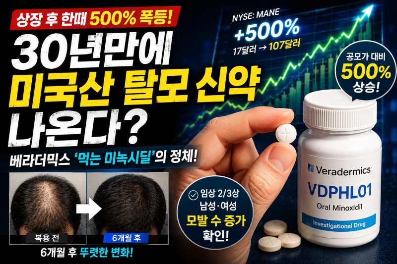 바르는 약보다 효과적인 먹는 탈모약 나온다? 베라더믹스 '먹는 미녹시딜'이 주목받는 이유 /....