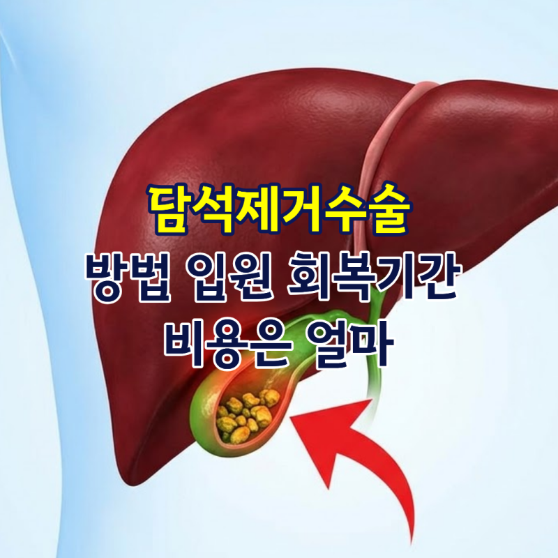 담석제거수술 방법 입원 회복기간 비용은 얼마