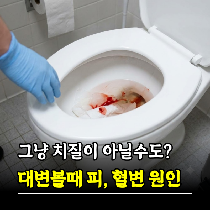 그냥 치질이 아닐수도? 대변볼때 피 혈변 원인 색깔로 구분