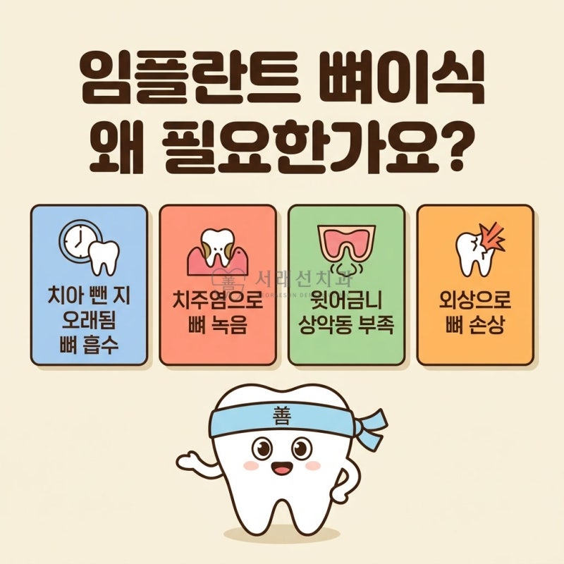 뼈가 부족해서 임플란트 못 한다고요?임플란트 뼈이식 총정리