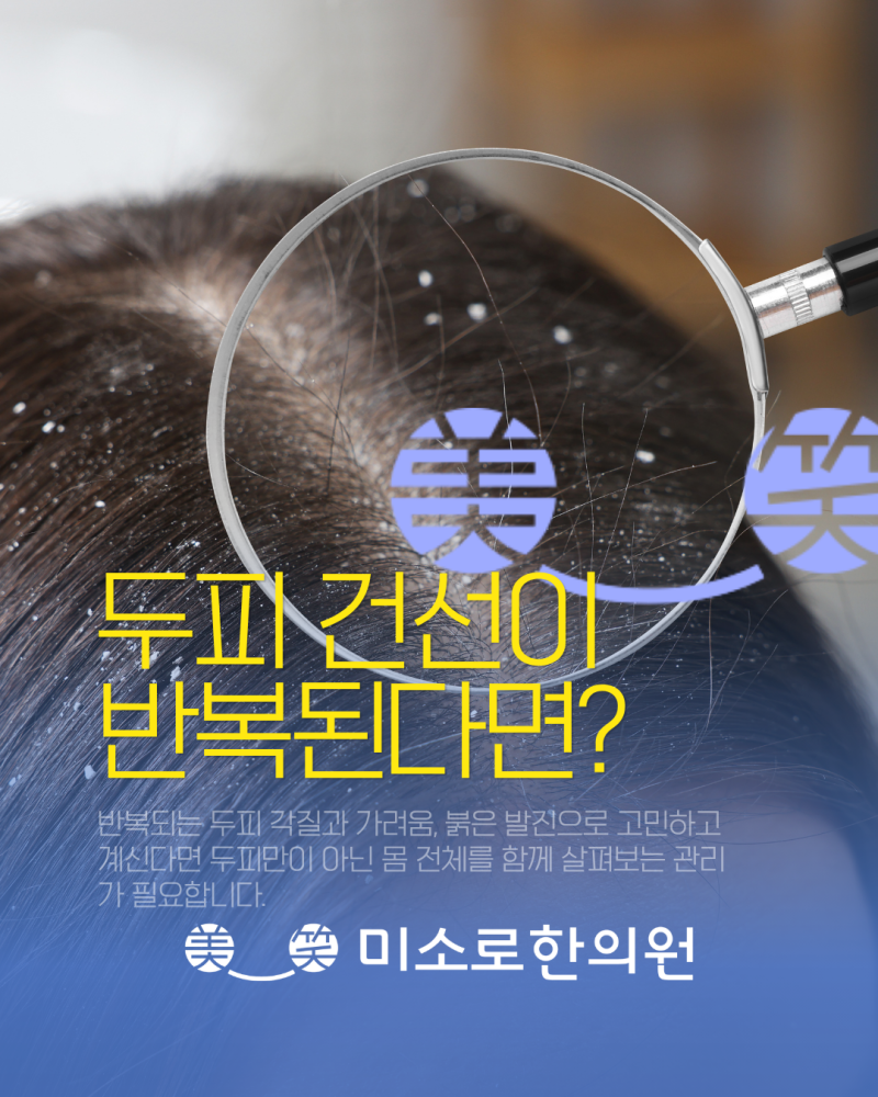 반복되는 두피 건선, 수원화성한의원에서 원인과 치료 알아보기