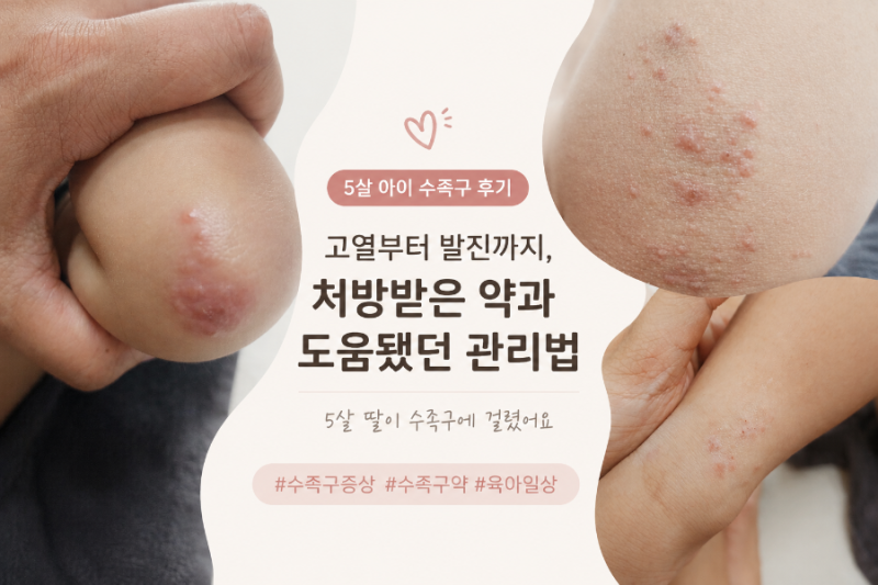 5살 아이 수족구 후기｜고열부터 발진까지, 처방받은 약과 도움됐던 관리법